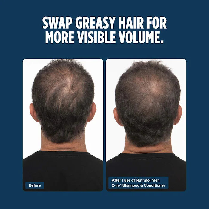 Men Active Cleanse Scalp Microbiome Shampoo and Conditioner