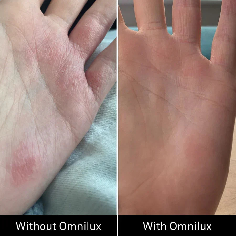 Omnilux Contour Glove